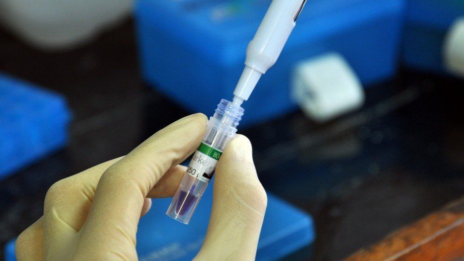 Un trasplante de células madre podría eliminar el VIH del organismo