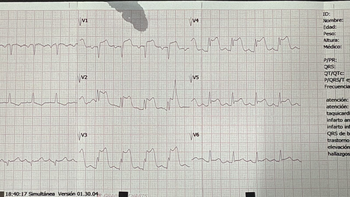 Aguilares: respuesta coordinada permitió salvar la vida de un paciente