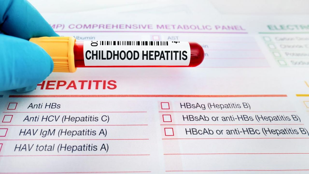 Ya son 450 casos de hepatitis grave en todo el mundo