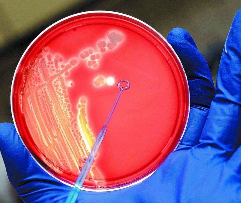 La resistencia a antibióticos causará 2,4 millones de muertes hasta 2050