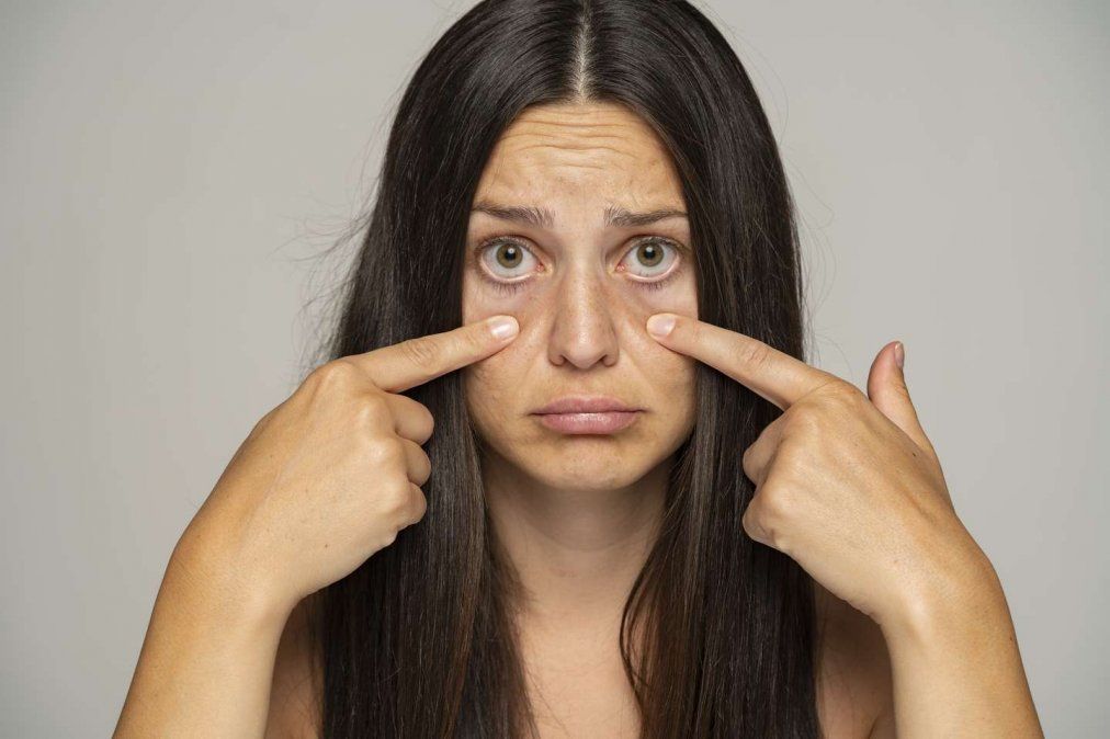 Dermatitis de párpados y caspa en las pestañas cuidados Dermatitis de párpados y caspa en las pestañas cuidados
