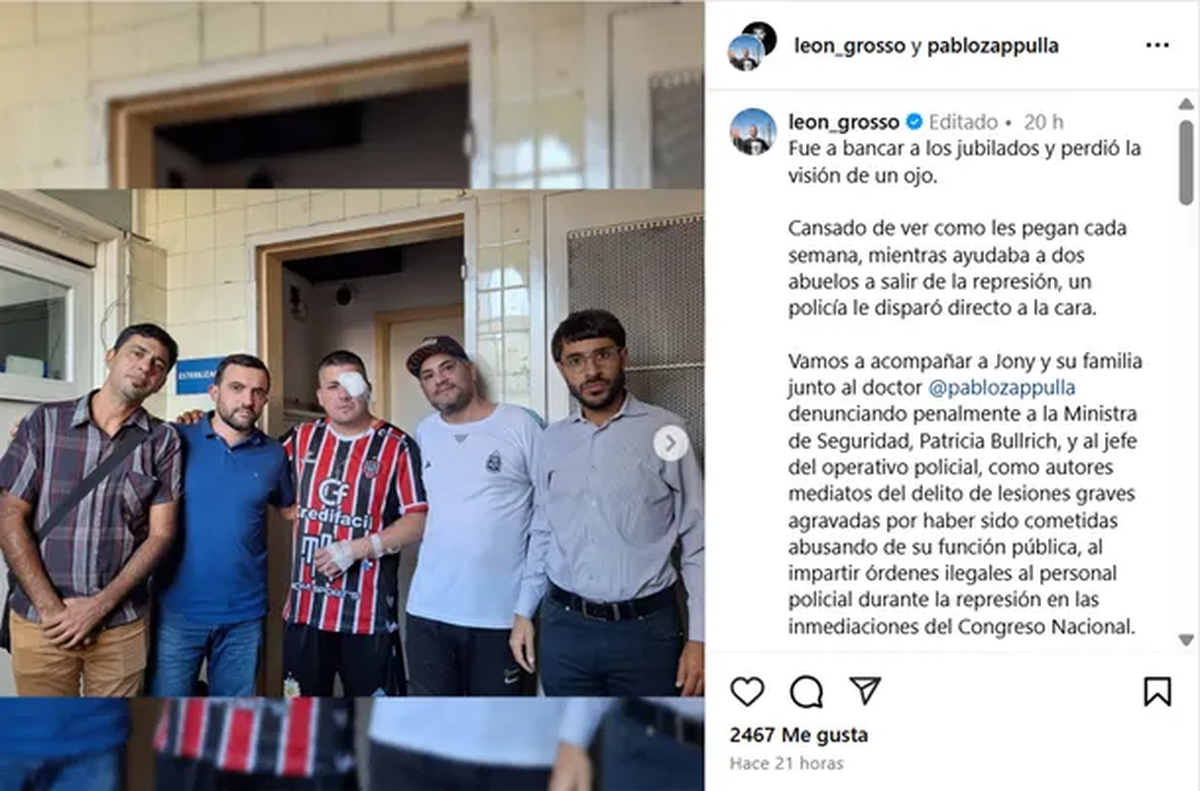 Hincha de Chacarita perdió la visión de un ojo por la brutal represión en Congreso. Foto: Minuto Uno Hincha de Chacarita perdió la visión de un ojo por la brutal represión en Congreso. Foto: Minuto Uno