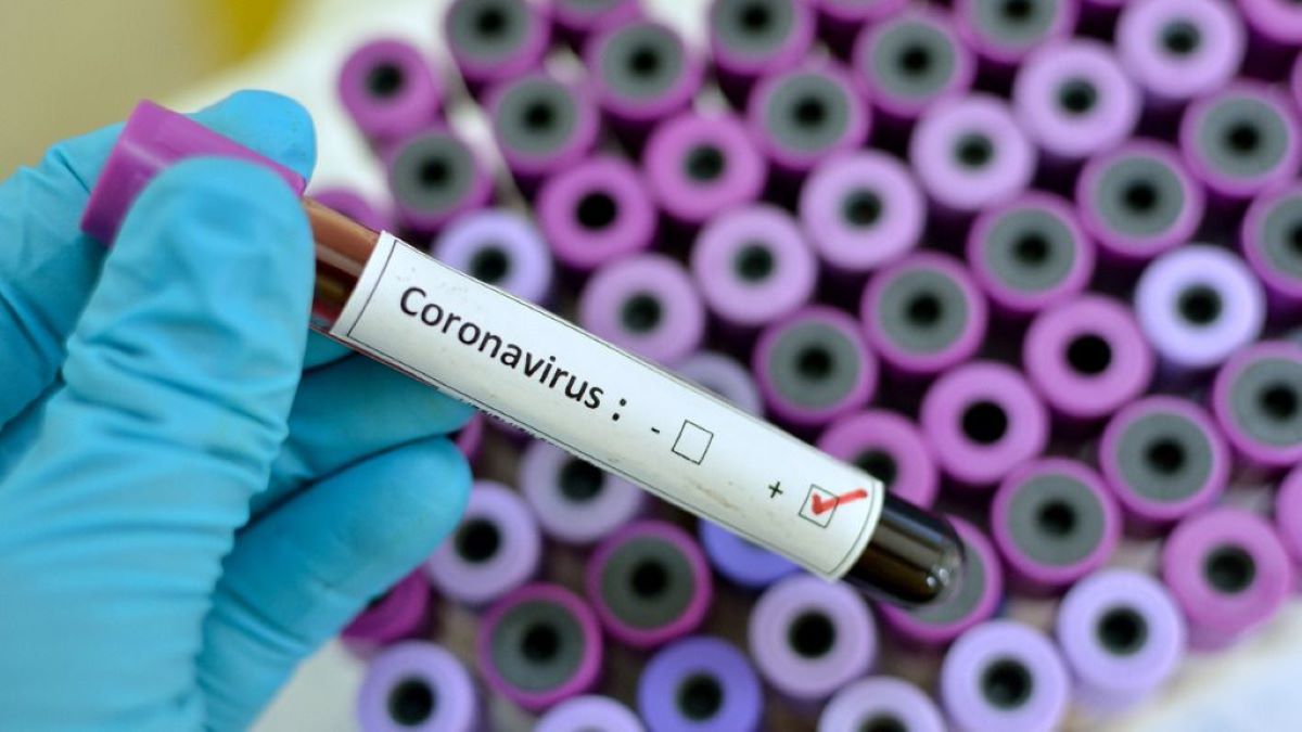 Uno de cada tres testeados dio positivo de coronavirus.