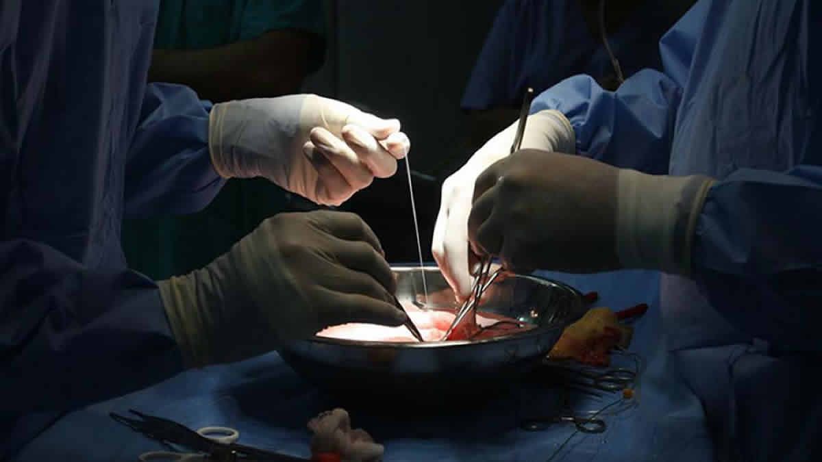 Tucumán lidera la donación de órganos en el país