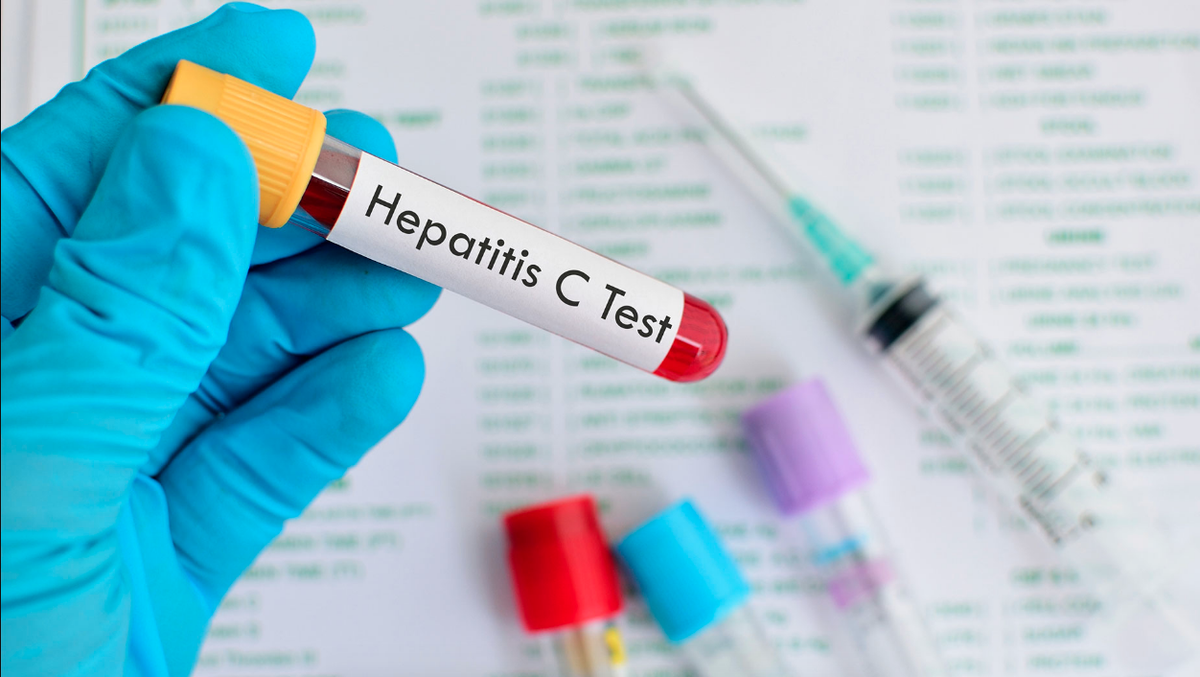 Hepatitis C: al ser asintomática la gente no se hace testeos