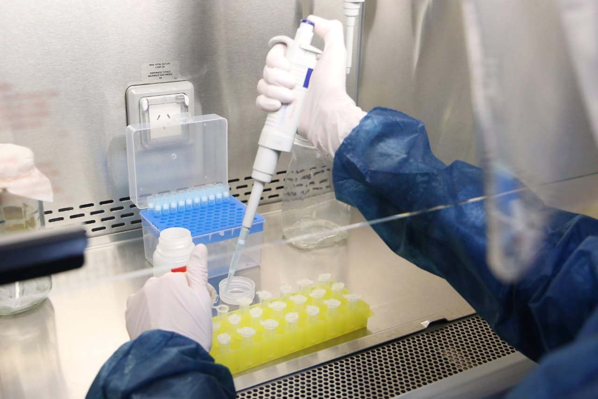 El Dr. Mansilla dijo que están trabajando con las muestras en el laboratorios para ver la carga viral de la variante.