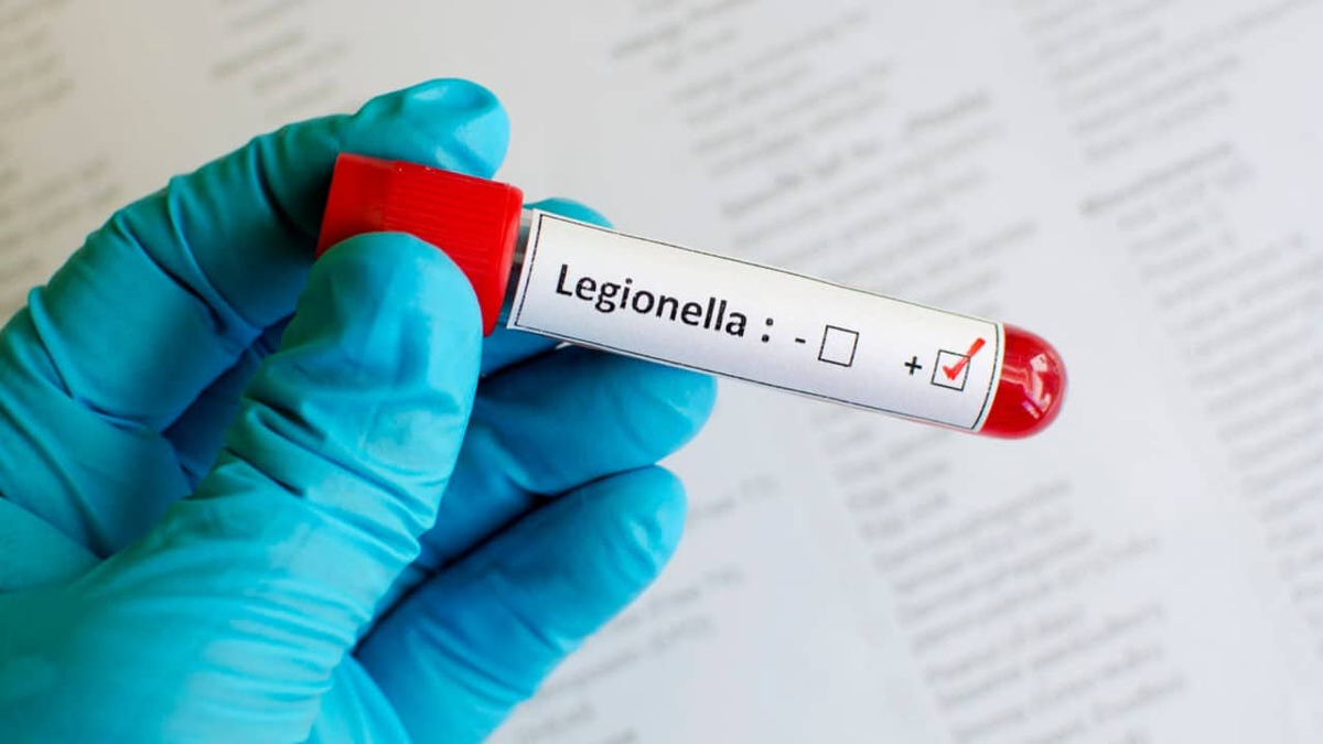 Legionella: principales características de la enfermedad