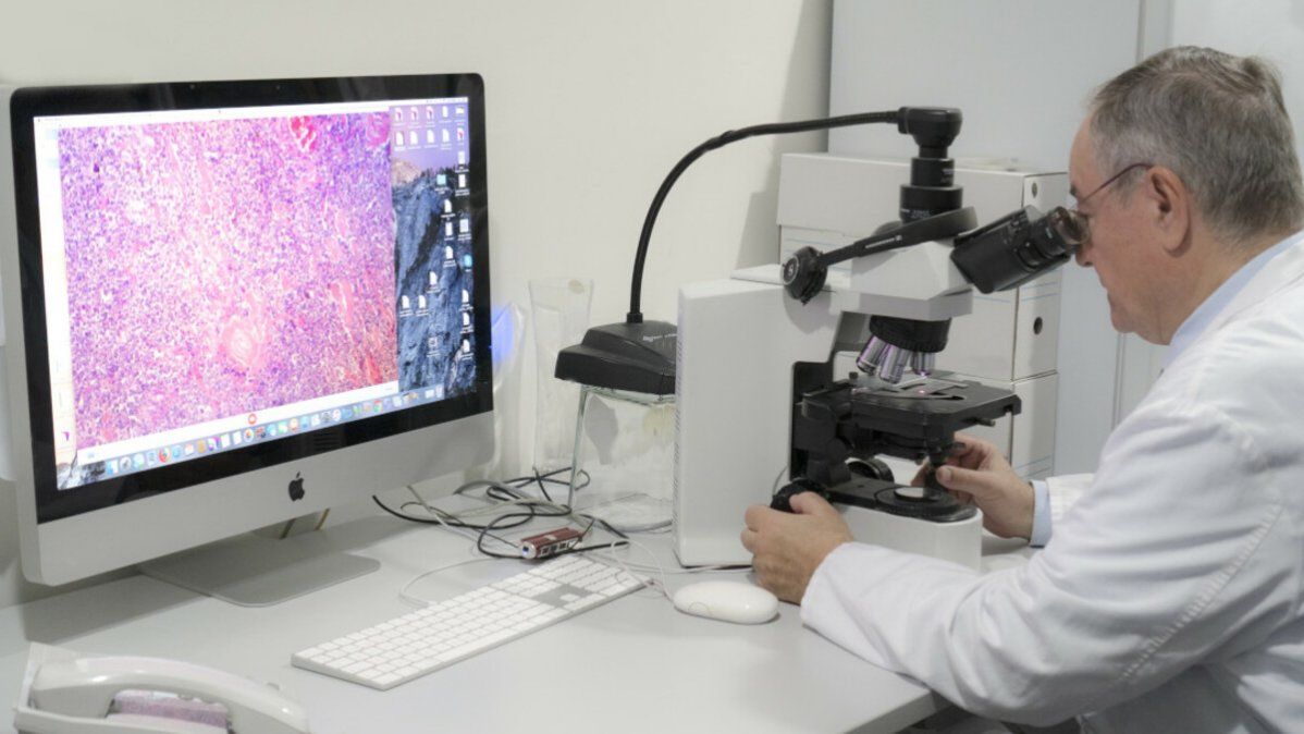Estudio del cáncer reemplaza el microscopio por pantallas