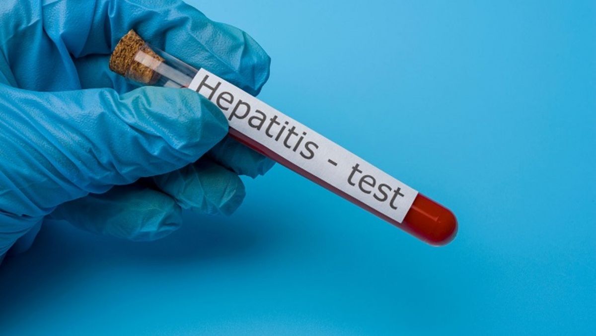 Se detectó el primer caso de Hepatitis aguda grave en Argentina