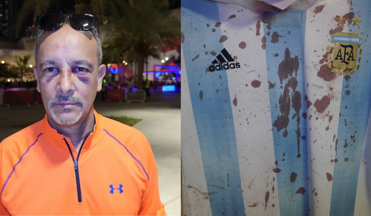 Un hincha argentino fue brutalmente golpeado en Qatar