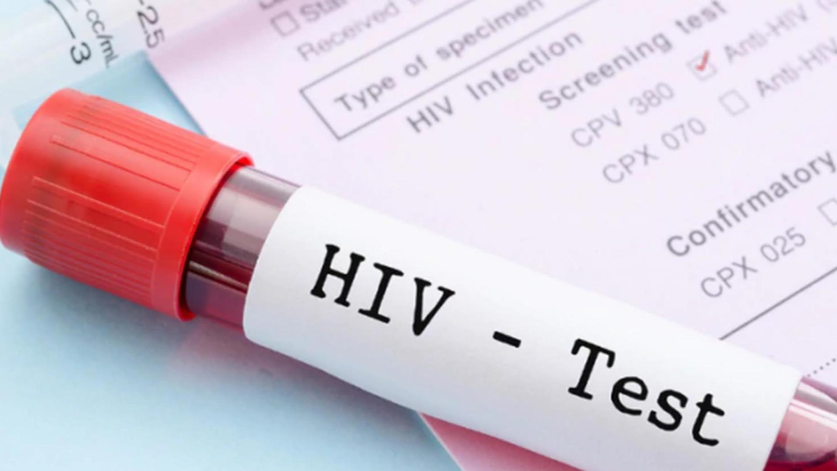 Habrá centros de testeo gratuito, voluntario y confidencial de VIH