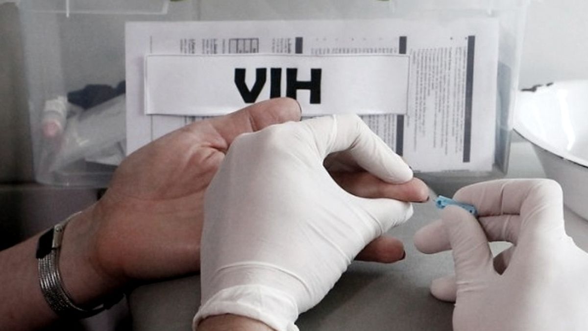 Argentina: El 44,5% de diagnósticos de VIH en 2022 fueron de forma tardía