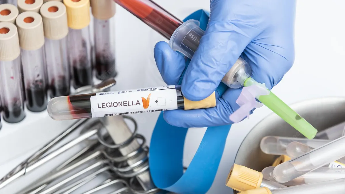 Legionella: ¿cuáles son los síntomas que pueden presentarse?