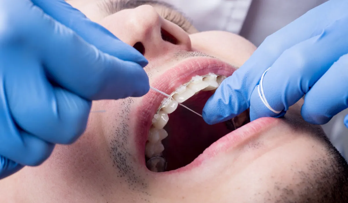 La ANMAT prohibió el uso y la venta de una marca de brakets por ser un riesgo para la salud. (Foto: Jujuy Al Momento)  